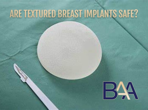 Are Textured Breast Implants Safe?