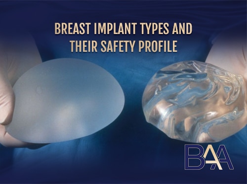Breast Implant Types and Their Safety Profile