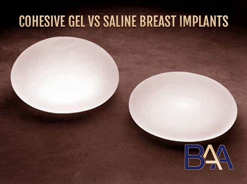 Comparison Between Cohesive Gel and Saline Breast Implants
