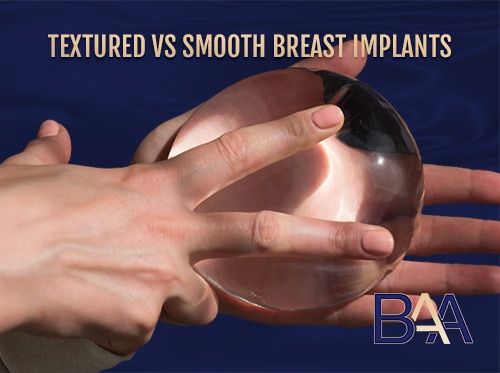 Textured vs Smooth Breast Implants