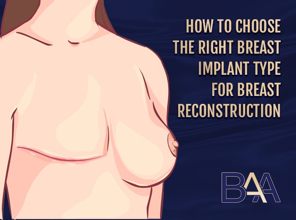 How to choose the right breast implant type for breast reconstruction