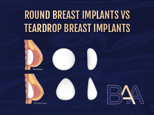 Breast Implant Flipped or Rotated