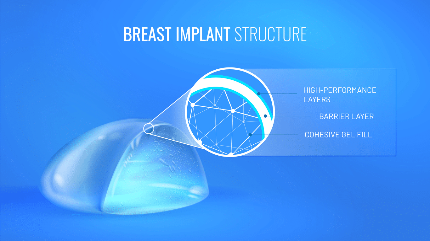 Silicone breast implant