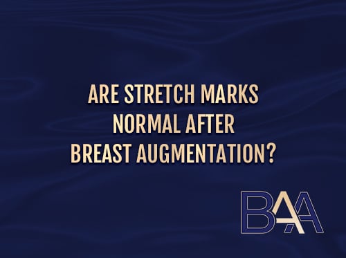 Are Stretch Marks Normal After Breast Augmentation?