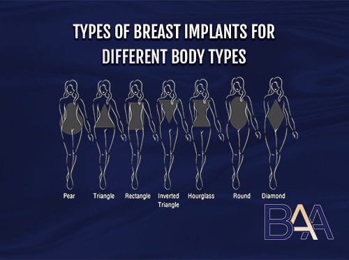 Types of Breast Implants for Different Body Types