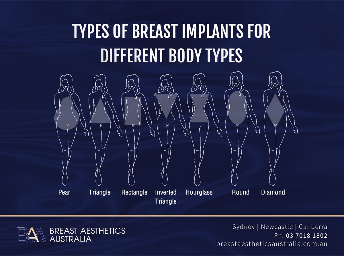 Types of breast implants for different body types - Infographic