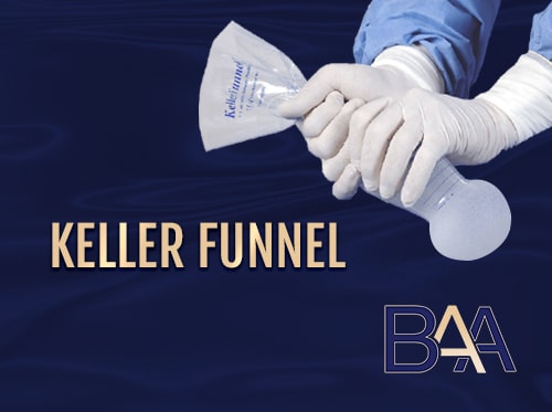 Keller Funnel - Featured Image