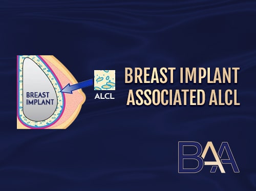 Breast Implant Associated ALCL