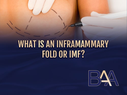 What is an Inframammary Fold or IMF