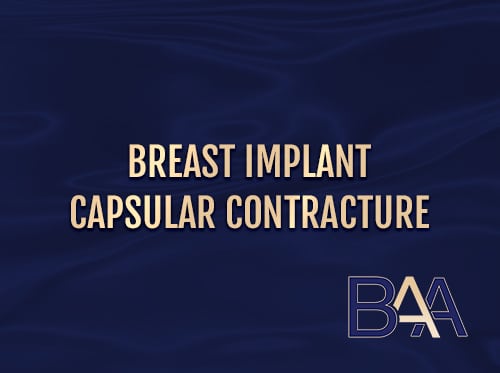 Breast Implant Capsular Contracture