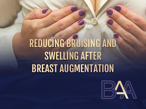 Reducing Bruising and Swelling after Breast Augmentation