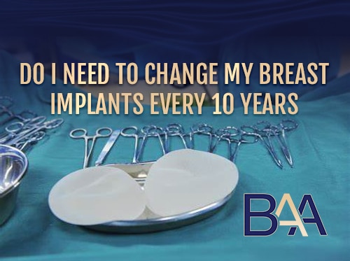 Do I Need to Change My Breast Implants Every 10 Years?